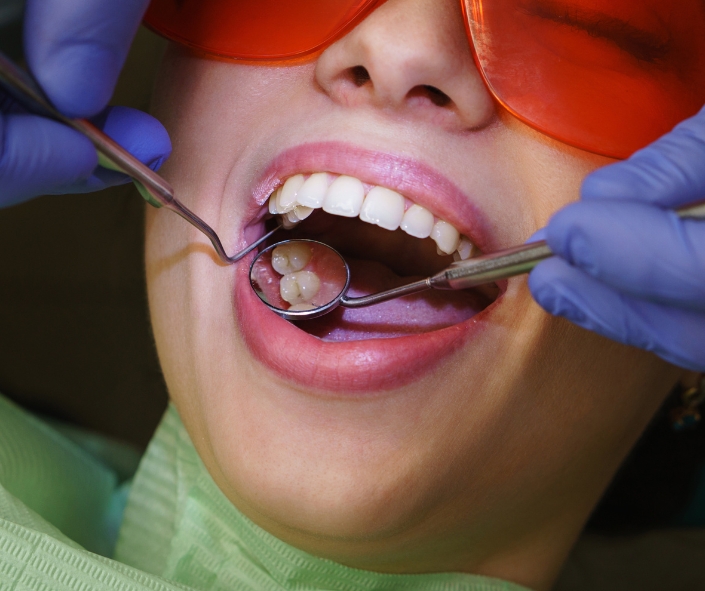 Close-up of a patient with a bright smile wearing orange protective glasses about to receive their deep cleaning, with a hygienist using a mirror and probe to inspect the teeth.